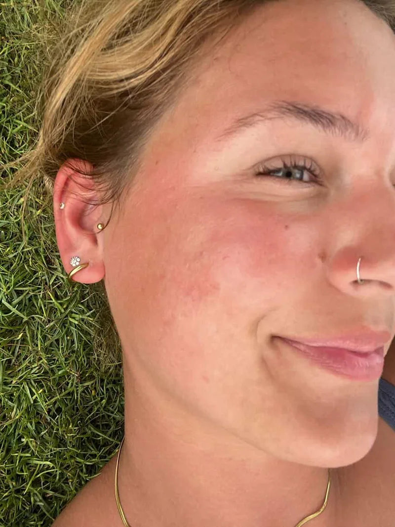 Samantha reclining on grass outdoors